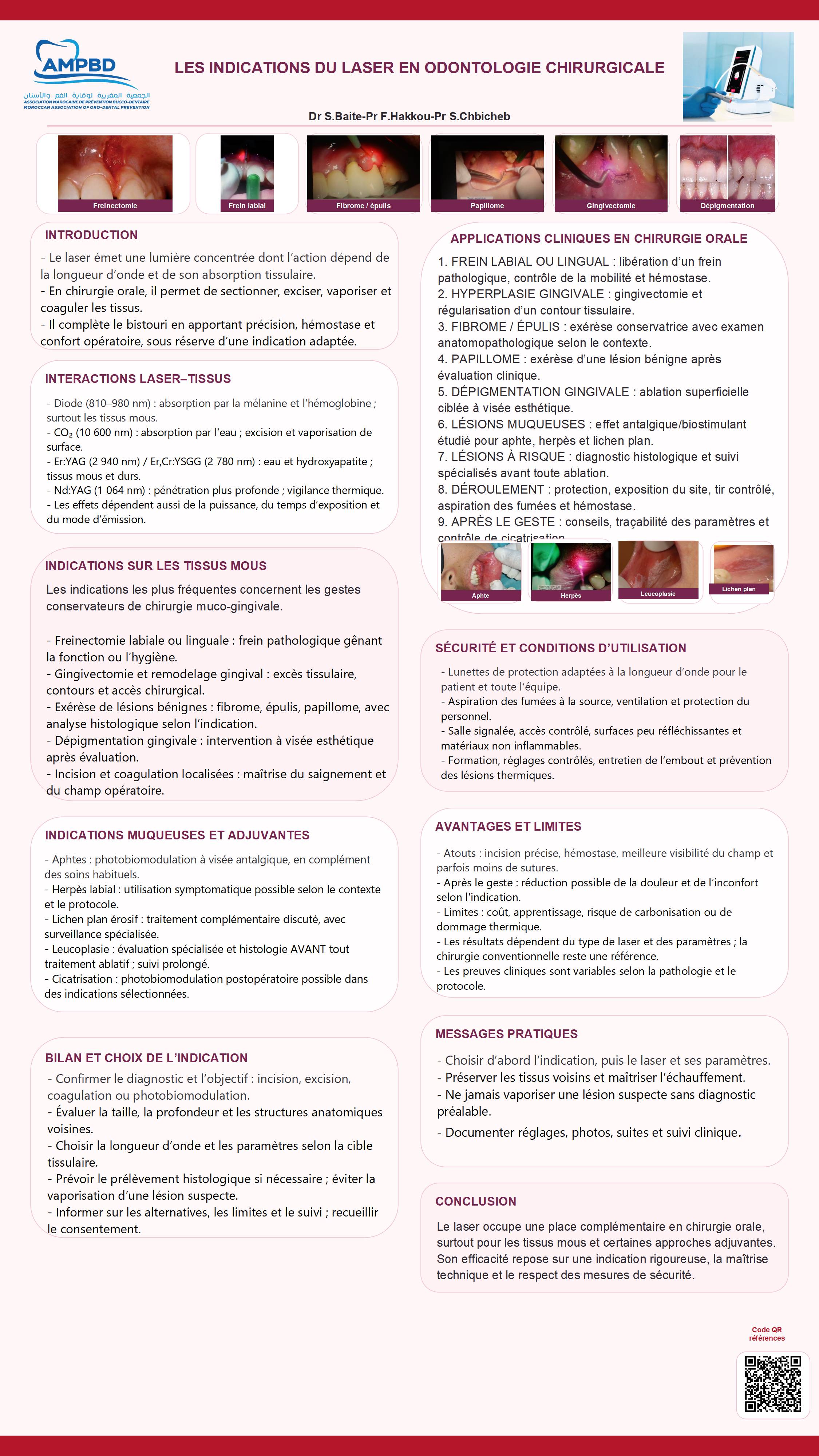 Les indications du laser en odontologie chirurgicale