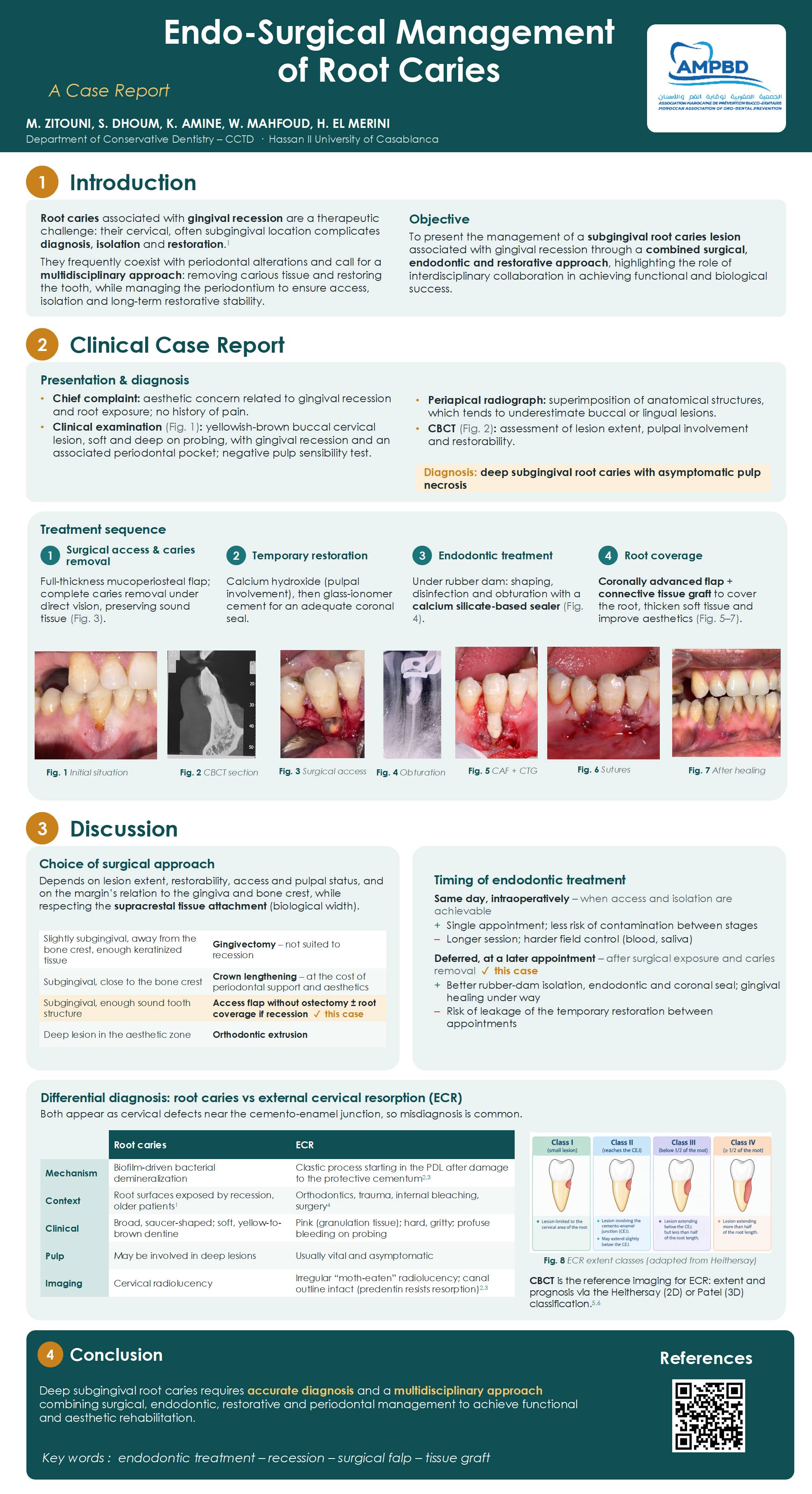 Endo-Surgical Management of Root Caries