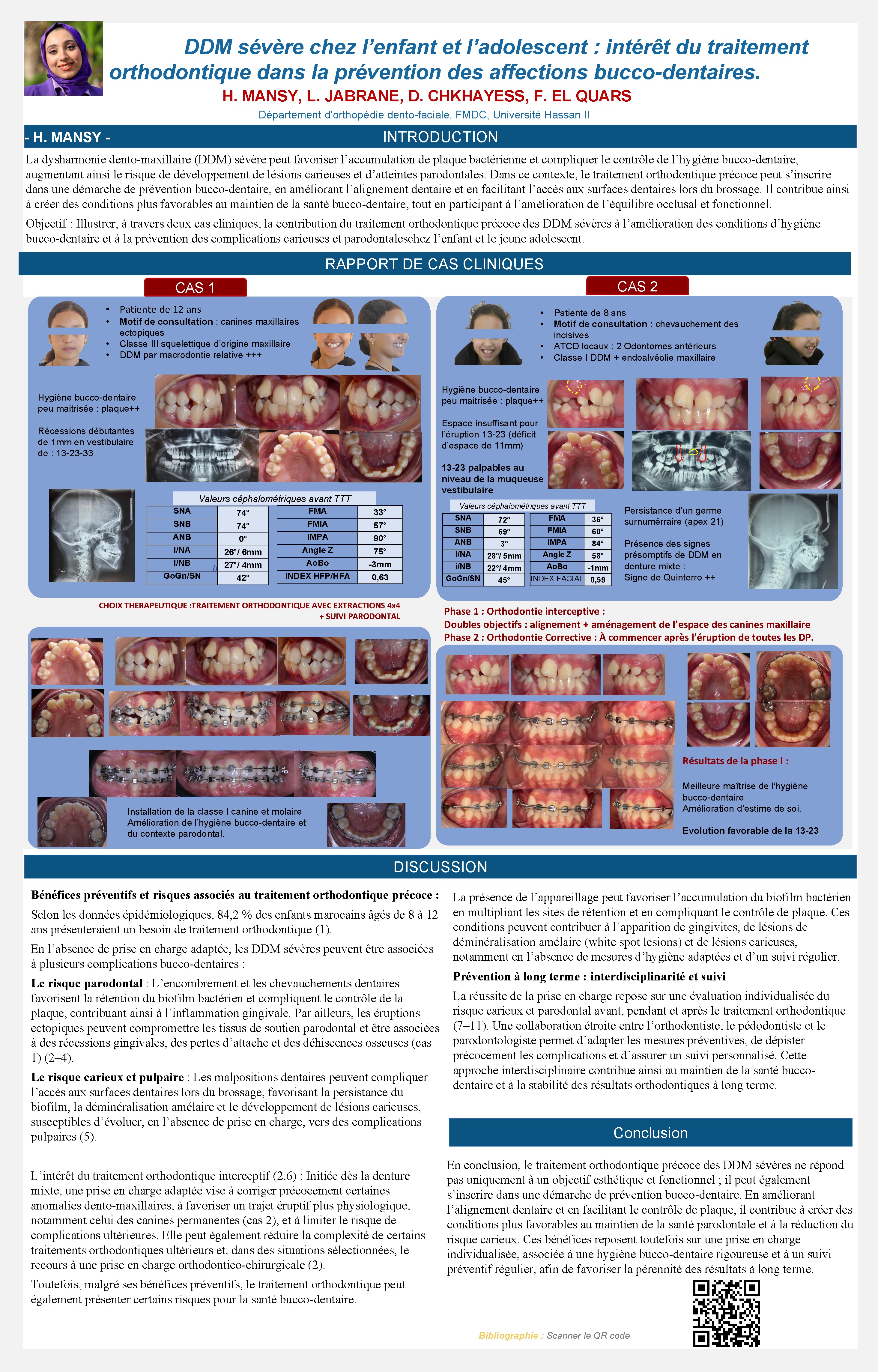 DDM sévère chez l’enfant et l’adolescent : intérêt du traitement orthodontique dans la prévention des affections bucco-dentaires