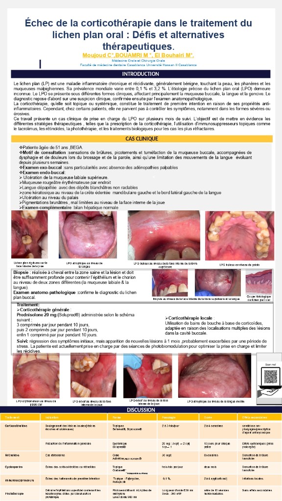 Échec de la corticothérapie dans le traitement du lichen plan oral : Défis et alternatives thérapeutiques