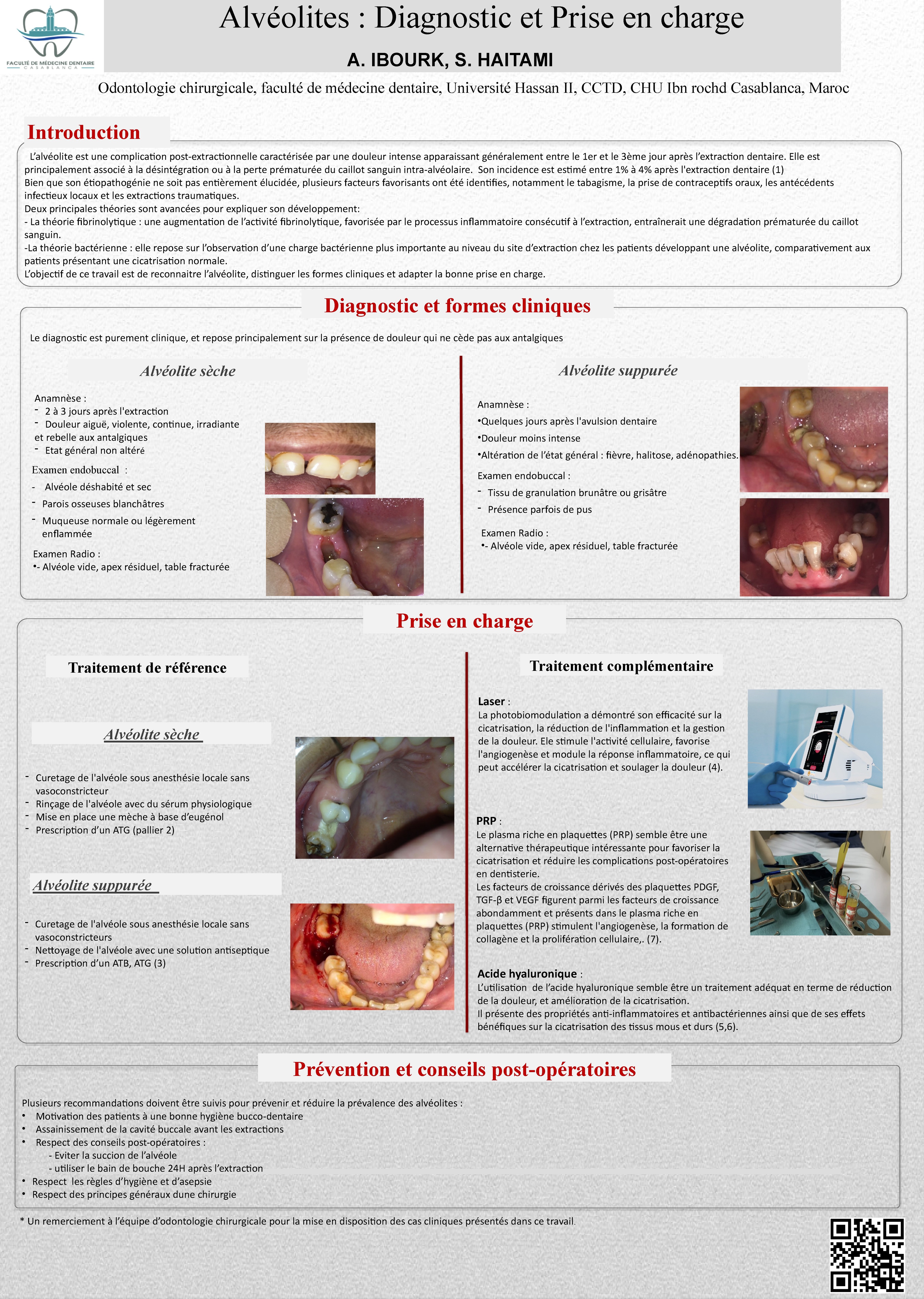 Alvéolites : Diagnostic et Prise en charge
