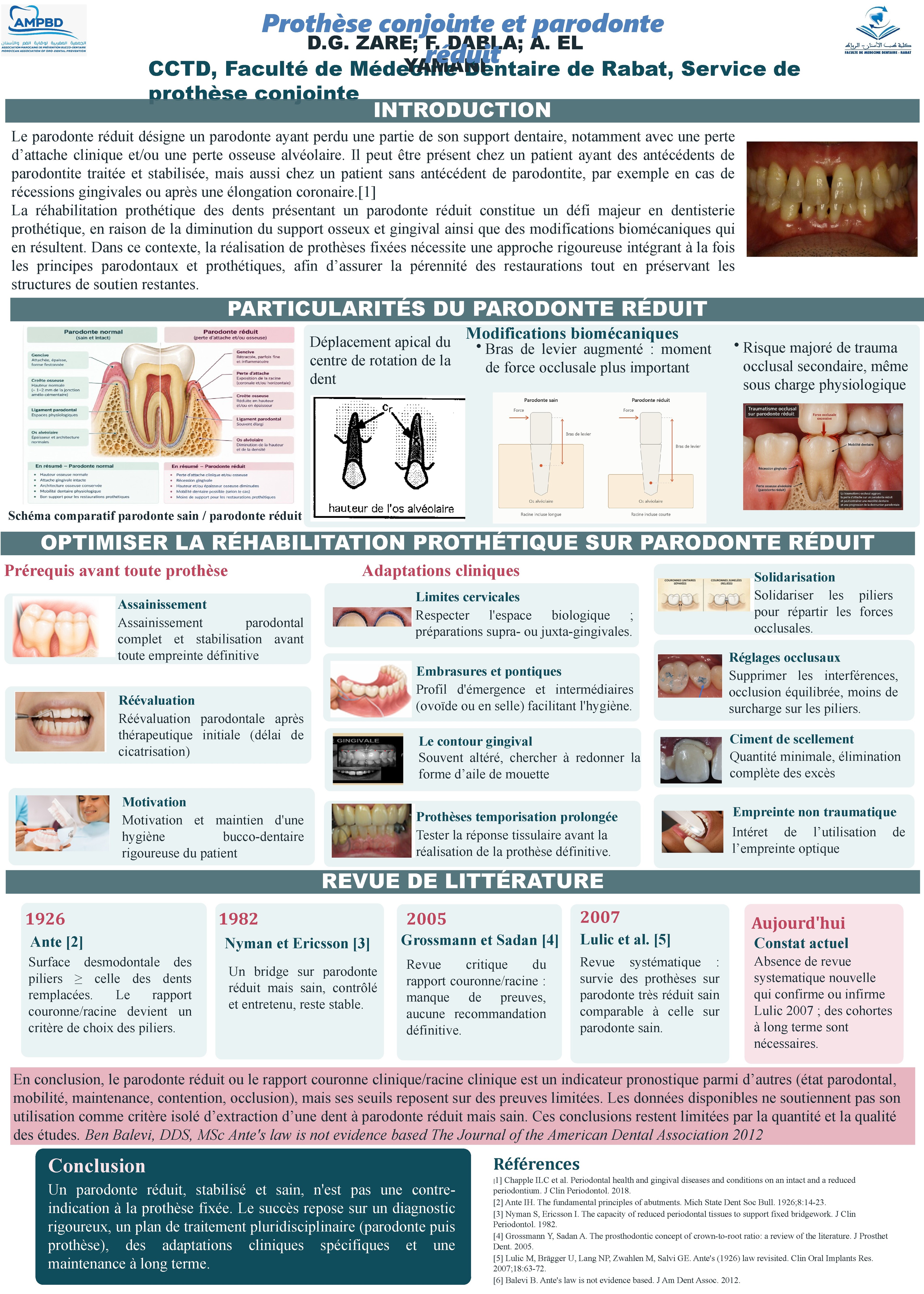 Prothèse conjointe et parodonte réduit