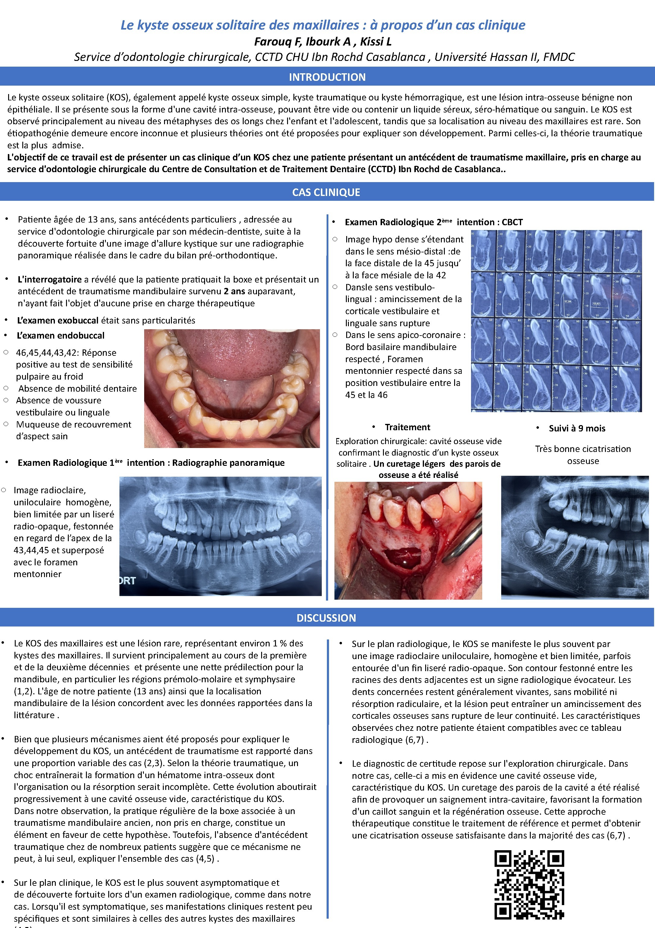 Le kyste osseux solitaire des maxillaires : à propos d'un cas clinique